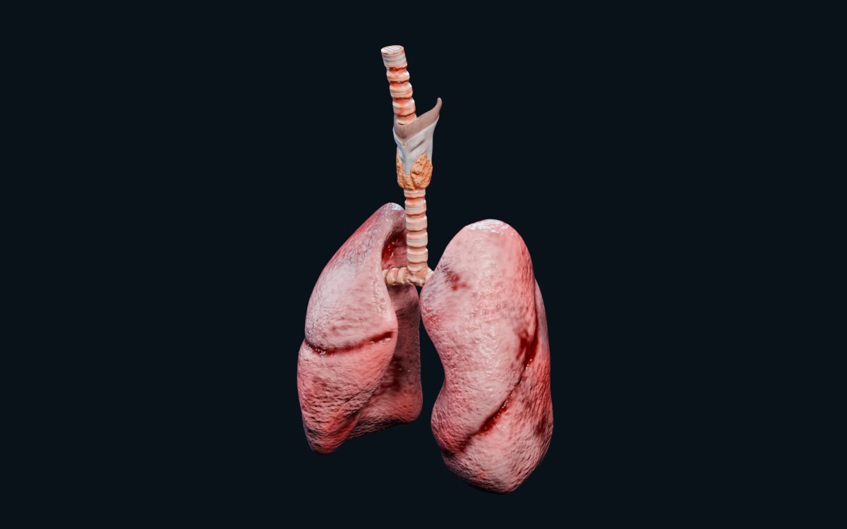 Pulmones en 3D